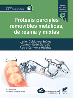 PPR metálicas, de resina y mixta